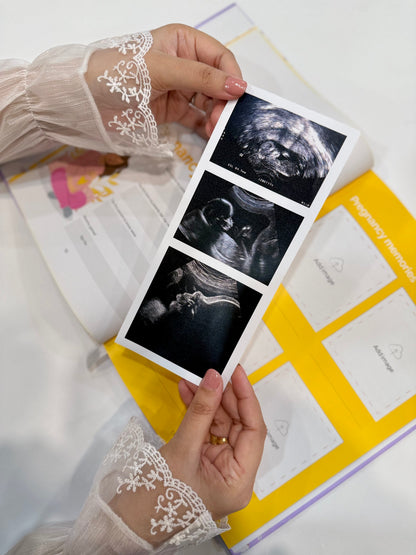 Baby Memories Journal Yellow Color